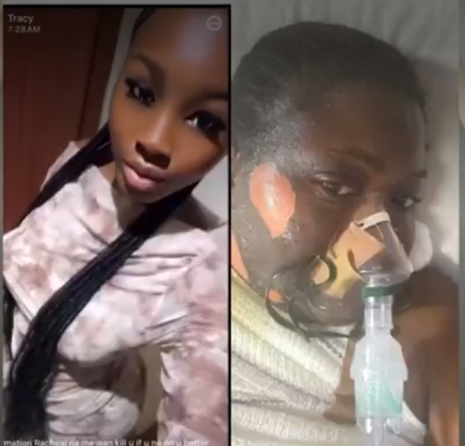 Justice Served: The Shocking Hot Water Assault Case in Edo State, Nigeria – A Deep Dive into VeryDarkMan’s Advocacy