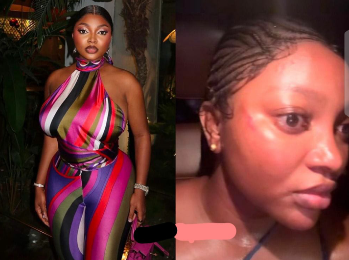 “An Officer Beat Me Inside My Own Car”: Influencer Papaya Ex Alleges Police Assault, Sparks Outrage Online