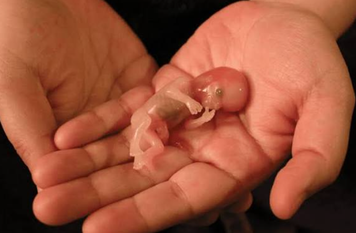 Outrage and Reflection as Viral Miscarriage Tweet Sparks Debate on Grief, Privacy, and Social Media Culture