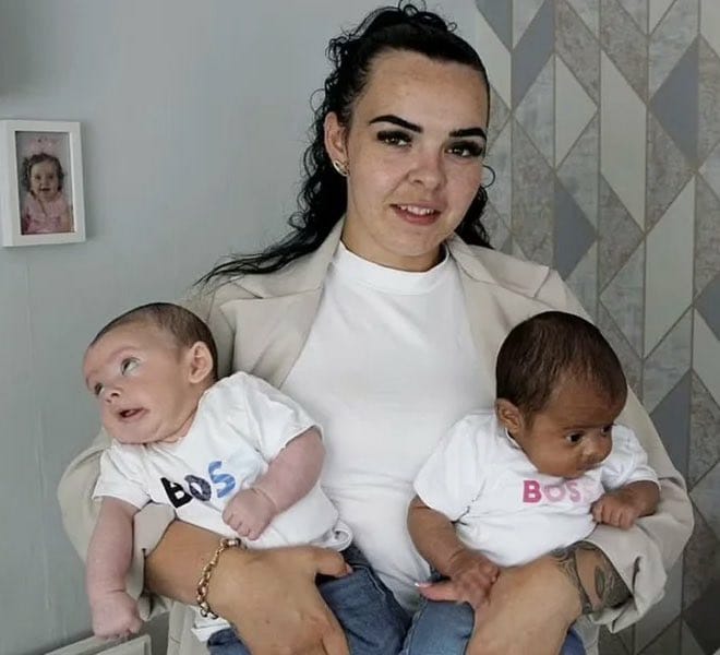 Two Fathers, One Pregnancy: Brazilian Teen’s Rare Twin Birth Stuns Medical Experts