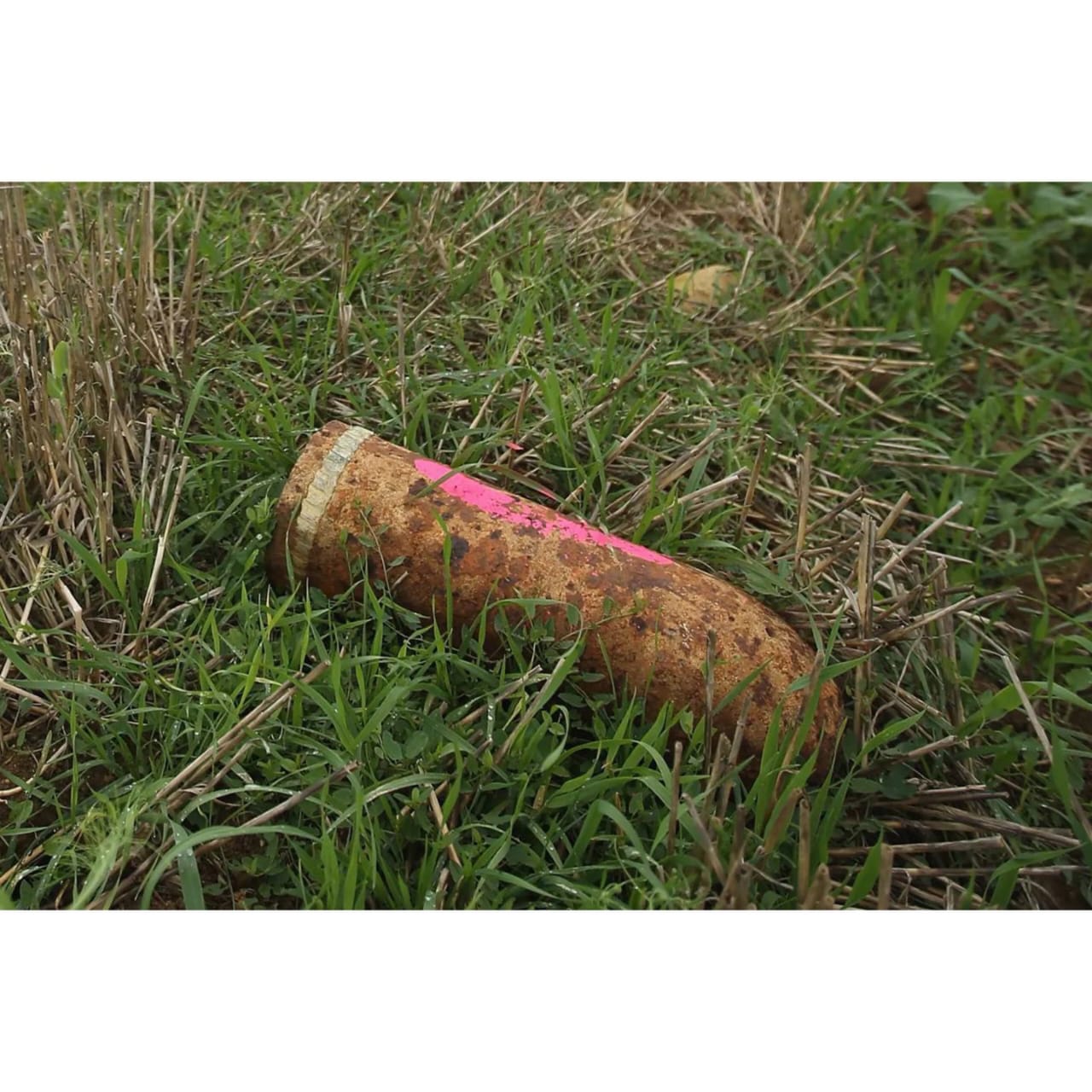 Shock in Toulouse: Hospital Evacuated After Doctors Discover Live World War I Shell Inside 24-Year-Old Patient