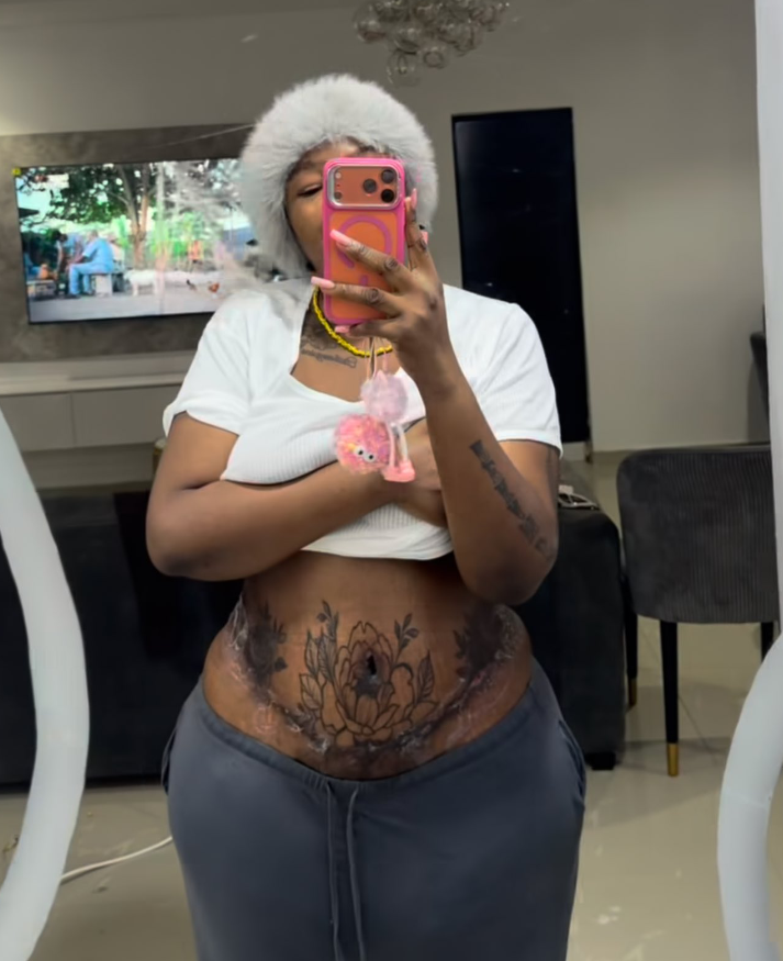 “I Regret the Puff Toto” — Influencer Judas Opens Up About Unexpected Reality After BBL Surgery