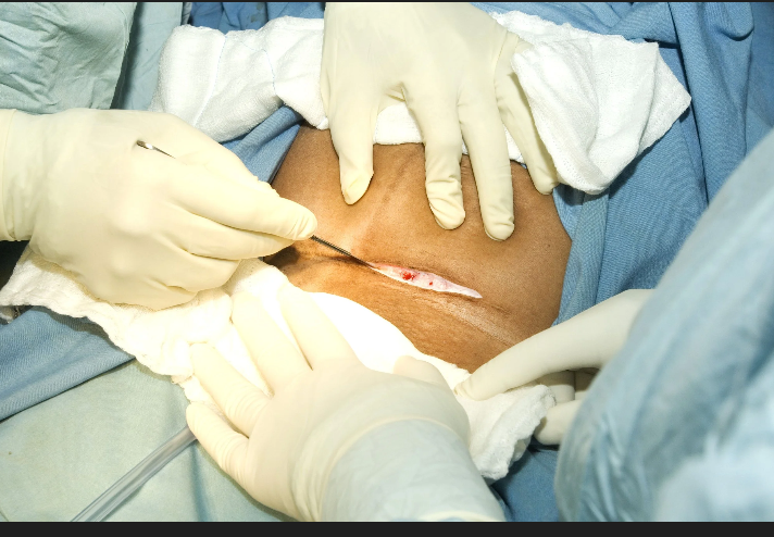 From Operating Table to Delivery Bed: Doctor Shares Dramatic Moment Prayer and Persistence Preceded Surprise Natural Birth