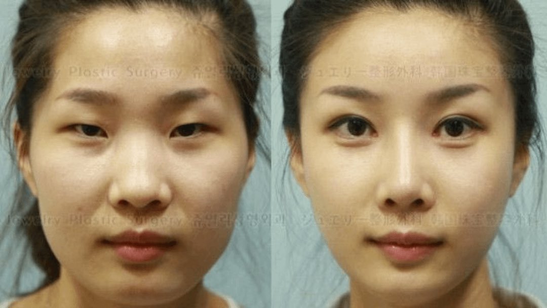 busterblog - Chinese Women Detained After Plastic Surgery Leaves Them Unrecognizable at Airport