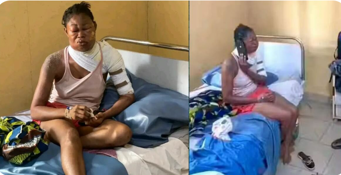 busterblog - Chaos on Campus: Abia State University Student Hospitalized After Brutal Hot Water Attack by Fellow Student