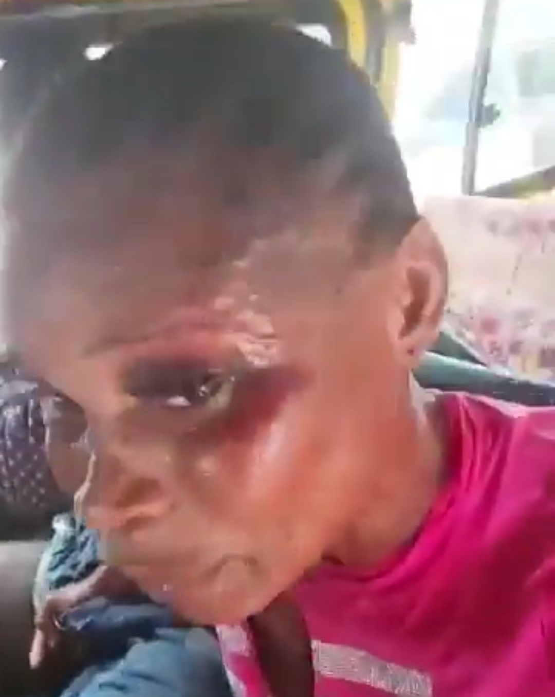Female Commercial Driver Seeks Justice After Alleged Brutal Assault by Lagos Urchin: A Call for Change